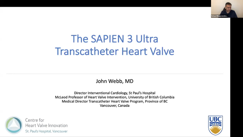 SAPIEN 3 Ultra - The Vancouver Experience