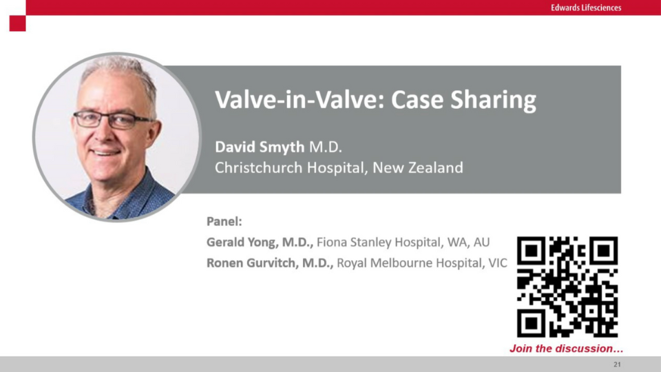 Valve-in-Valve Case Sharing
