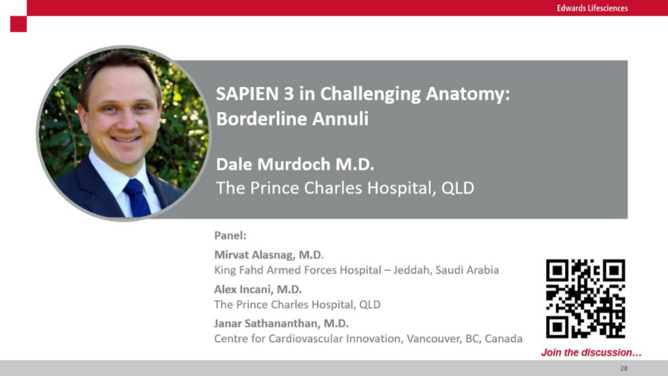 SAPIEN 3 in Borderline Annuli - What to fill?