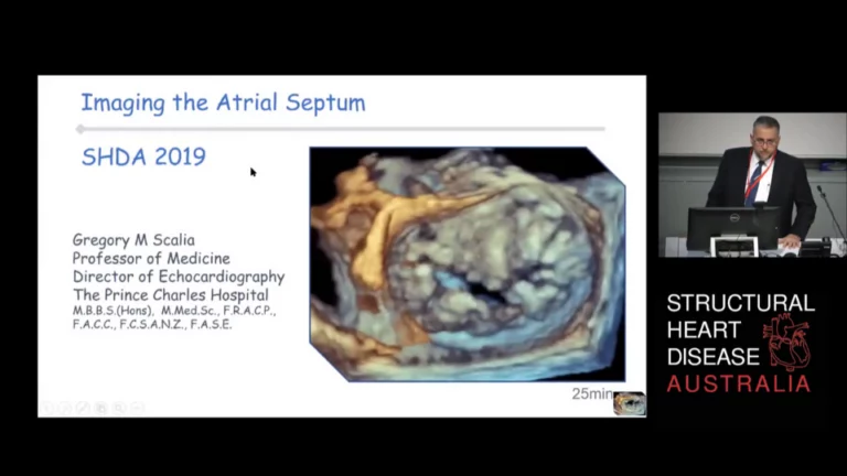 Atrial Septum - Anatomy, Echocardiography and Interventions