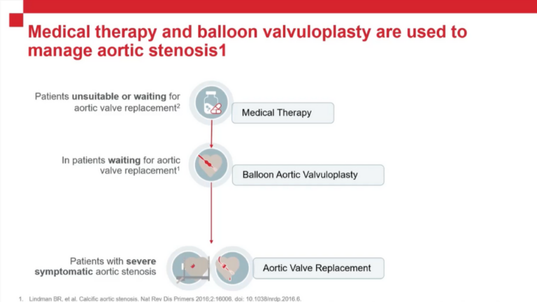 Catching a Killer: Aortic Stenosis