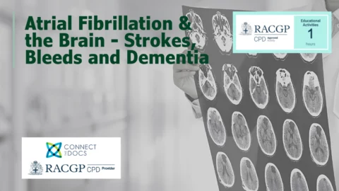 Atrial Fibrillation & the Brain – Strokes, Bleeds, and Dementia (23-25)