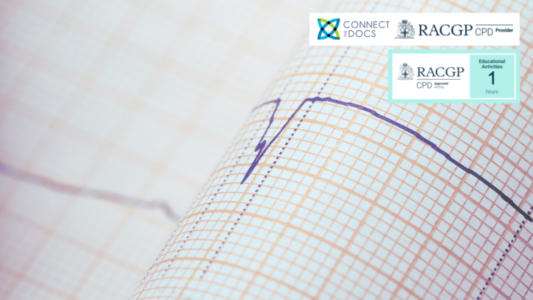 Atrial Fibrillation Rate vs Rhythm Control RACGP CPD