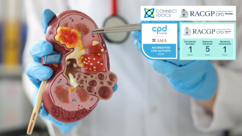 Kidney Cancer – Diagnosis and Treatment RACGP CPD Course AMA CPD Home