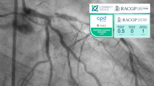 Calcium Scoring & CT Coronary Angiography RACGP CPD Course AMA CPD Home