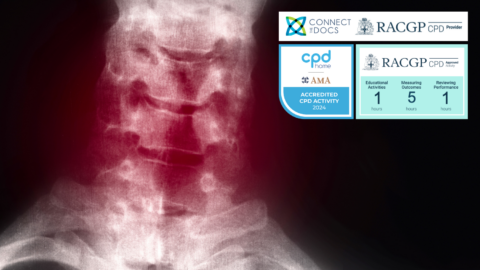 Cervical Myelopathies and Radiculopathies RACGP CPD Course AMA CPD Home