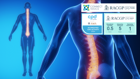 Degenerative Spine Disease in the Aging Population RACGP CPD Course AMA CPD Home