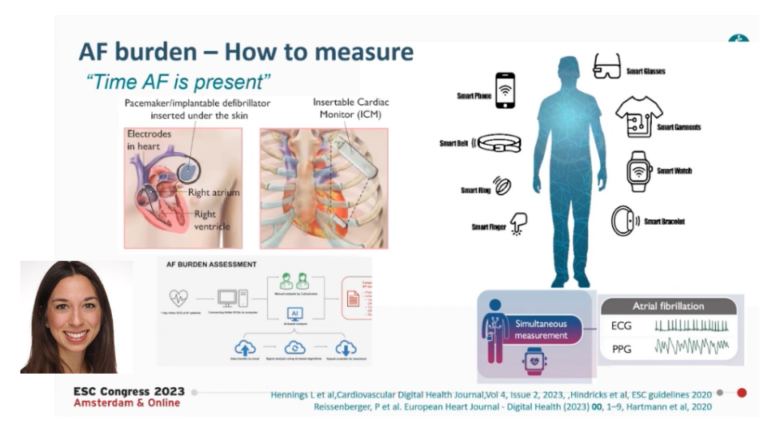 Atrial Fibrillation - State of the Art - Melanie Gunawardene