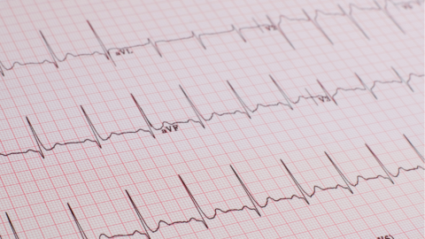 ECG Masterclass Webinar