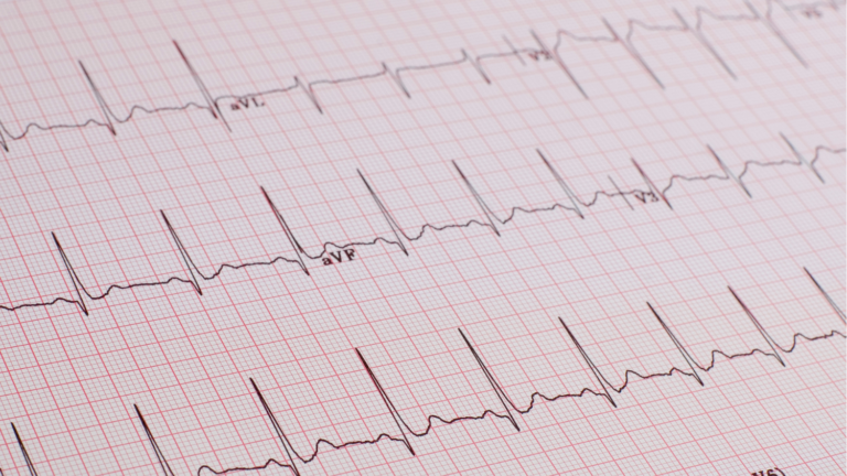 ECG Masterclass Webinar