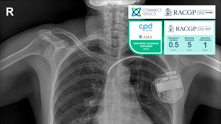 Advances in Pacemakers CPD Activity