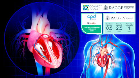 Clipping the Tricuspid Valve AMA CPD Home and RACGP CPD Activity Dr Jason Sharp