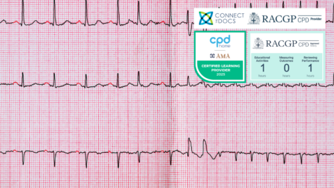 Atrial Fibrillation in 2024 RACGP CPD Home Course