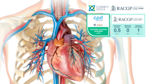 Heart Failure with Preserved Ejection Fraction (HFpEF) and Atrial Fibrillation Dr David Chieng