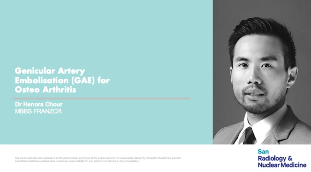 Genicular Artery Embolisation (GAE) for Osteo Arthritis