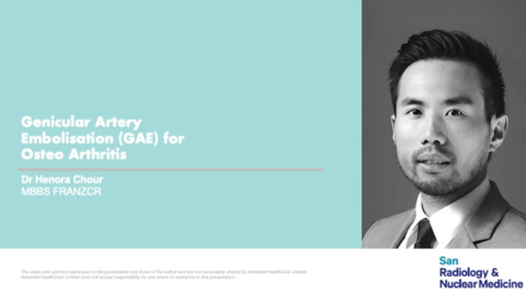 Genicular Artery Embolisation (GAE) for Osteo Arthritis
