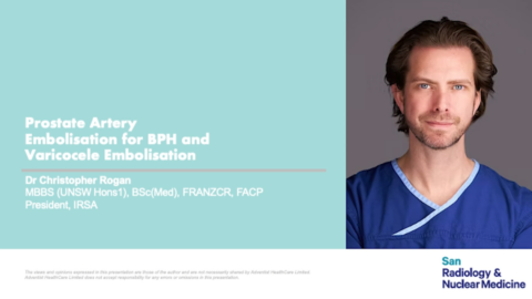 Prostate Artery Embolisation for BPH and Varicocele Embolisation